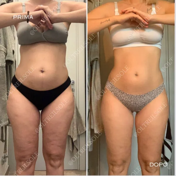 bendaggi snellenti gambe