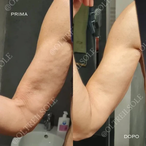 bendaggi snellenti gambe