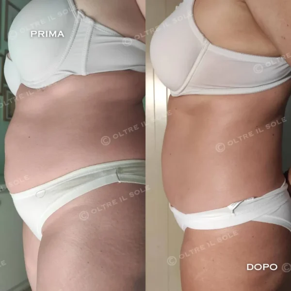 Benda riducente addome e fianchi