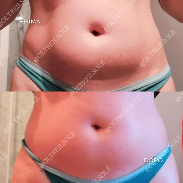 gel effetto caldo cellulite e adiposità localizzata