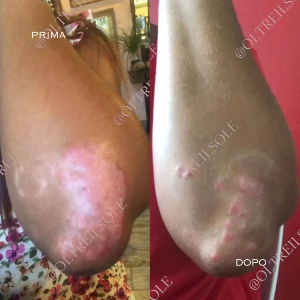 crema mani e piedi nutriente